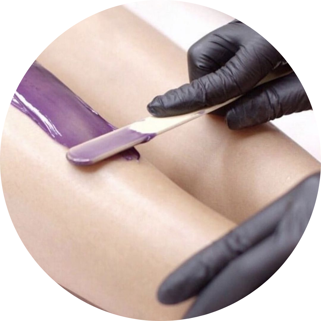 Электроэпиляция